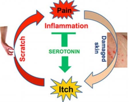 gãi ngứa, cơn đau, giải mã, bí ẩn, chất dẫn truyền thần kinh, serotonin