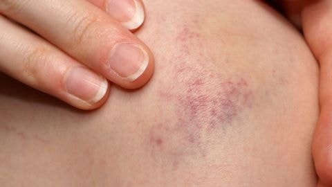 Mẹo vặt hay,mẹo mặt cuộc sống,mẹo vặt gia đình