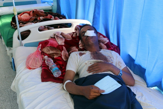Yemen: Đang ăn cưới bị dội bom, ít nhất 40 người chết - Ảnh 1.