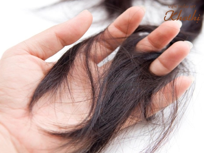 Rụng tóc nhiều: Nguyên nhân, Dấu hiệu, phân loại và chẩn đoán