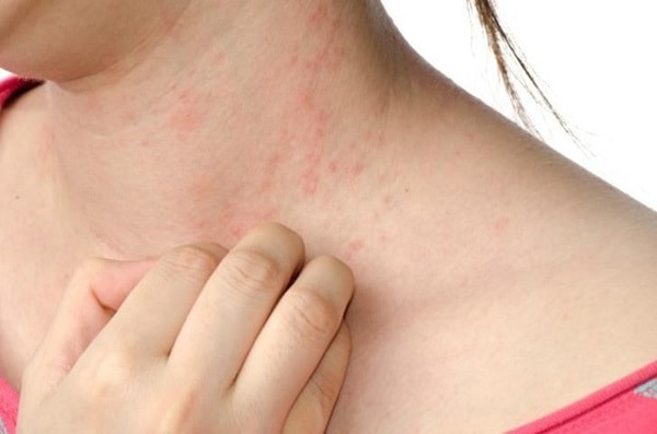 Những loại thuốc gia đình nào cũng cần chuẩn bị trong những ngày Tết