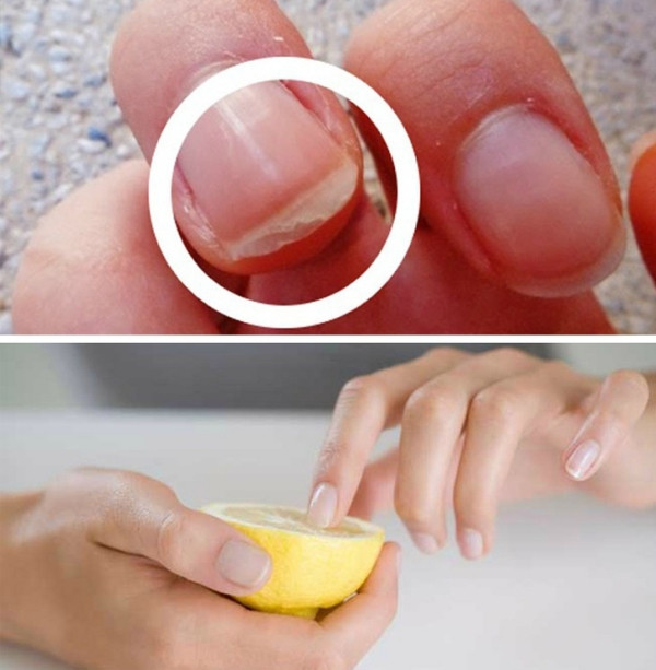 Giúp móng tay chắc khoẻ Móng tay yếu, dễ gãy, có thể cải thiện đơn giản bằng cách ngâm đầu ngón tay vào nửa quả chanh. Lặp lại 3 - 4 lần/tuần để thấy hiệu quả rõ rệt.