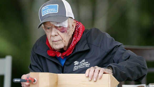 Cựu tổng thống Mỹ Carter bị xuất huyết não - Ảnh 1.