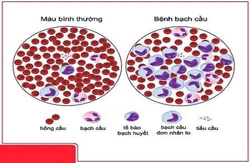 cơn ớn lạnh đột ngột