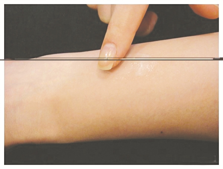 Phương pháp thử da ở mặt trong cánh tay