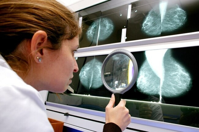 Chụp Xquang tuyến vú   Hiện nay chụp X quang tuyến vú là một trong những phương tiện quan trọng để tầm soát và chẩn đoán sớm ung thư vú. Phụ nữ từ 40 tuổi trở lên nên tiến hành chụp X quang định kỳ một lần/năm theo tư vấn của các bác sĩ. 