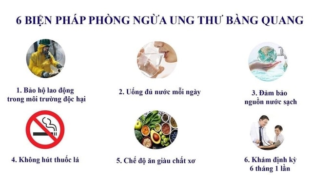 5 dấu hiệu sớm tố bạn có thể bị ung thư bàng quang - 2