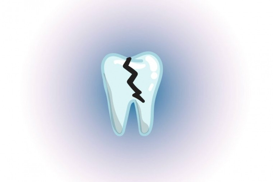Làm nứt men răng: Thói quen nhai đá lạnh có thể làm mòn men răng, về lâu dài có thể làm răng bị vỡ, nứt. Nếu nghiêm trọng, bạn thậm chí có thể phải dùng liệu pháp tủy răng để điều trị.