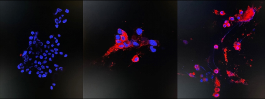 Hình ảnh miễn dịch huỳnh quang để phát hiện protein NP của virus biến thể, nhóm không bị nhiễm (trái) và nhóm bị nhiễm 48 giờ (giữa, phải). Nguồn: Đại học Hong Kong
