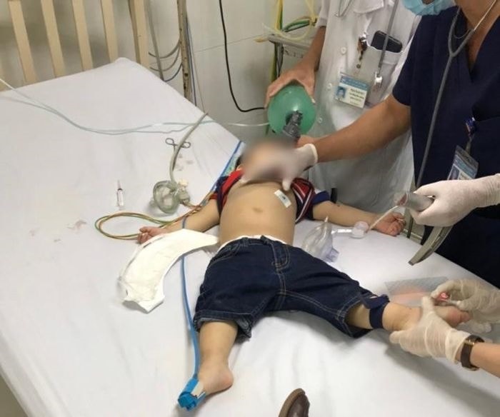 Bé trai 22 tháng tuổi bị hóc thạch rau câu may mắn được cứu sống.
