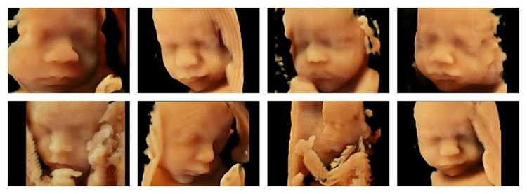 Các thời điểm để thực hiện 5 xét nghiệm có giá trị trong quá trình mang thai - Ảnh 4.