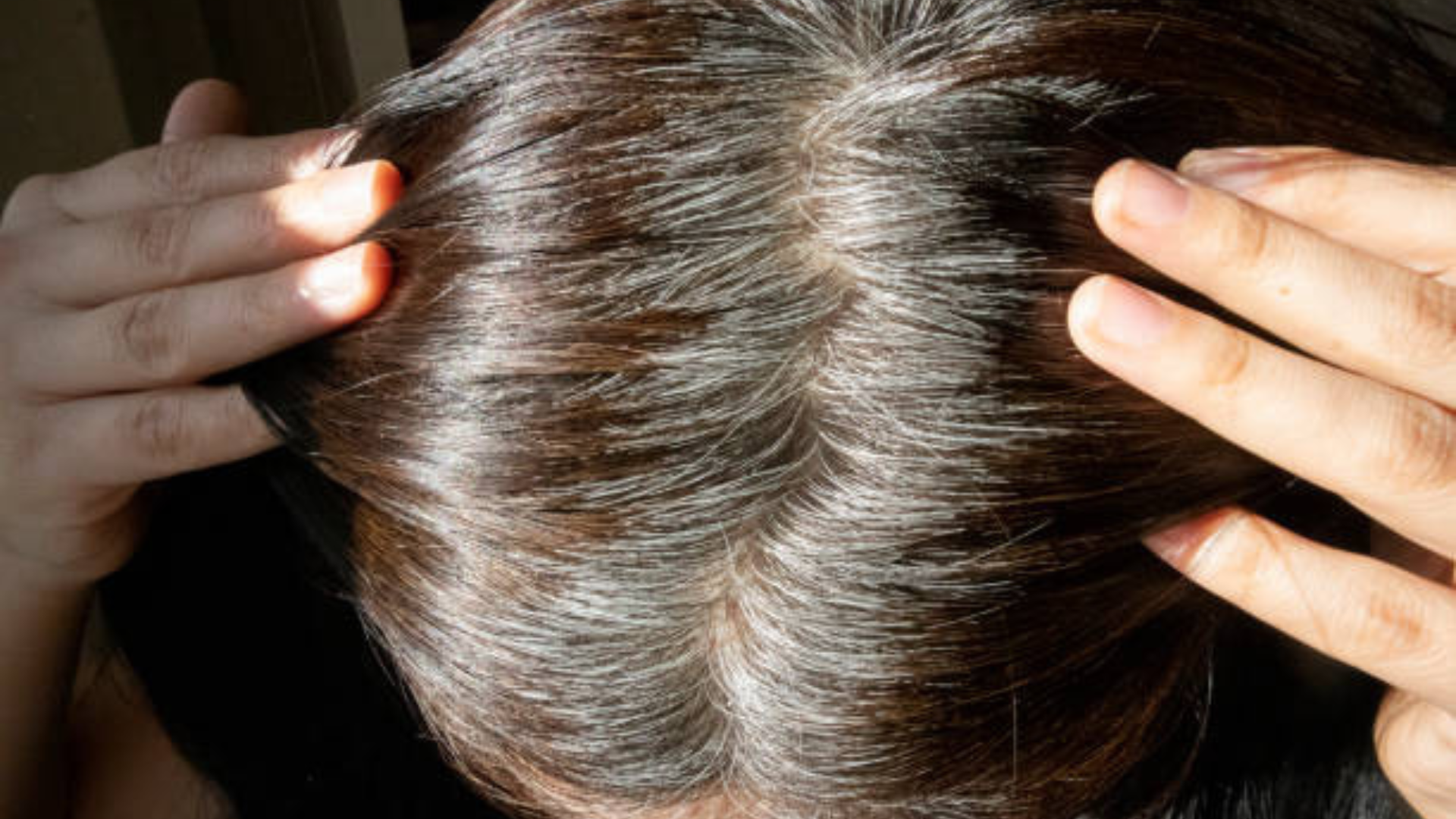 Không thiếu những mẹo tuyệt vời giúp bạn chống lại tình trạng tóc bạc sớm, nhưng bạn cần phải kiên trì thực hiện mới hiệu quả. (Ảnh minh hoạ: Pixabay)