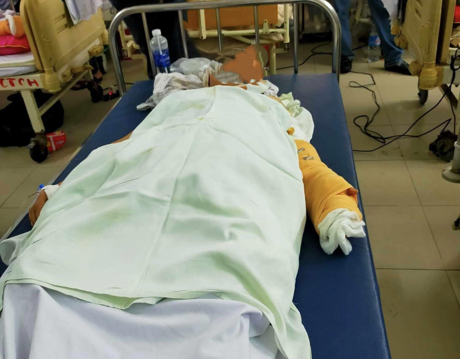 Nạn nhân bị Bùi Hoài Nam đâm trọng thương cấp cứu tại bệnh viện - Ảnh: H.A.