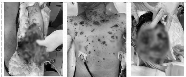 Hình ảnh đa chấn thương của bệnh nhi khi nhập viện - Ảnh: BVCC