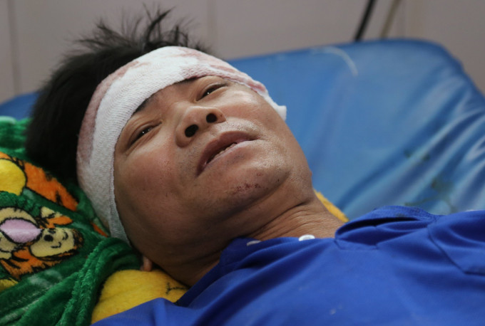 Ông Hoàng Văn Kính nằm điều trị tại Bệnh viện đa khoa Thống Nhất sau vụ nổ lò hơi. Ảnh: Đình Văn