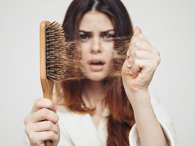 8 thói quen ăn uống không lành mạnh khiến tóc gãy rụng- Ảnh 1.