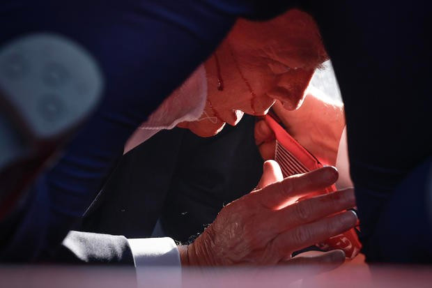 Ông Trump bị thương ở tai phải. (Nguồn: Getty Images)