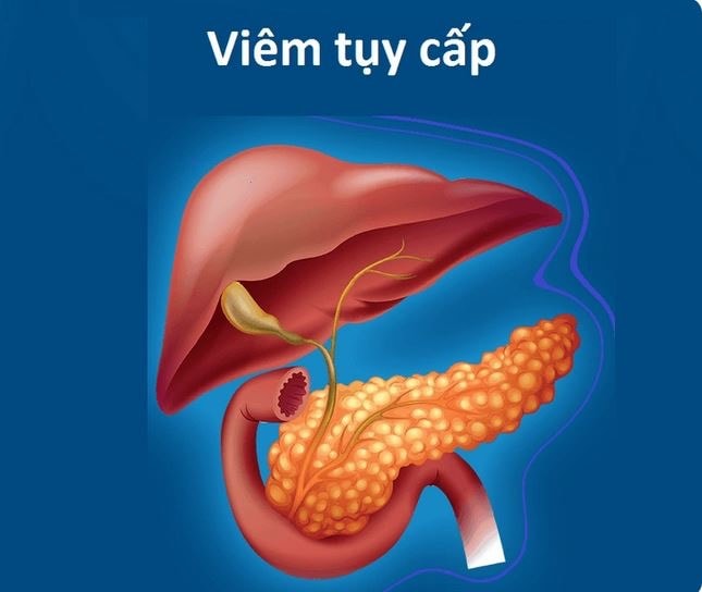 viem-tuy-cap.jpg