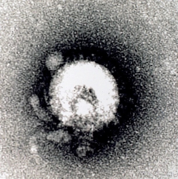 Vietnam has successfully developed testing capabilities for all emerging infectious diseases, including H5N1, Ebola, and new strains of coronavirus. In the photo: The National Institute of Hygiene and Epidemiology captures the structure of the H5N1 virus using a JEM 1010 electron microscope (2004). (Photo: VNA)