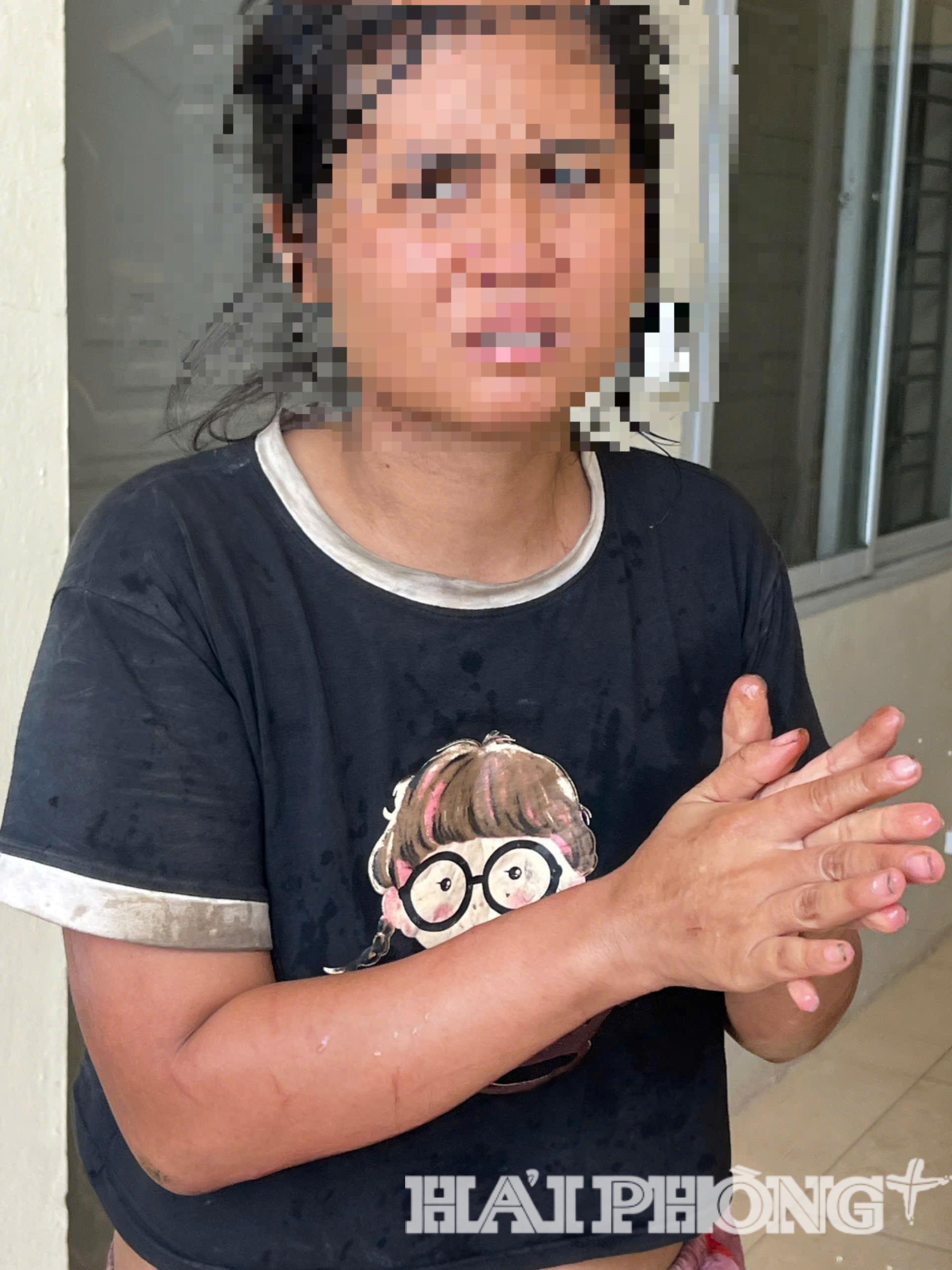 កង្វះជាតិ lactose-1-.jpg