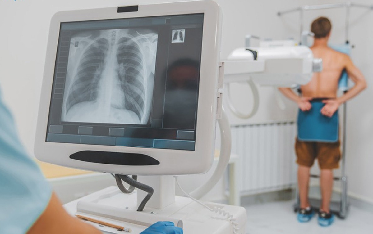 Каковы последствия воздействия рентгеновских лучей? 18371533.jpg