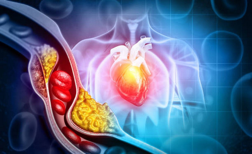 Một trong những bước dễ nhất để cải thiện sức khỏe tim mạch là loại bỏ hoặc hạn chế nghiêm ngặt những thực phẩm gây hại. (Nguồn: iStock)