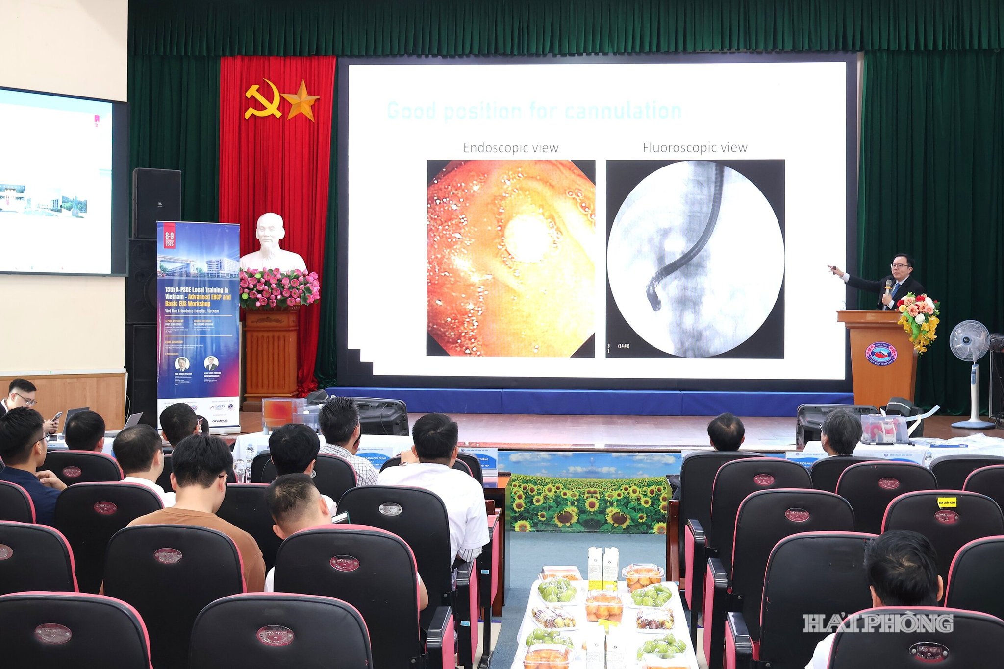 tieu-hoa.jpg