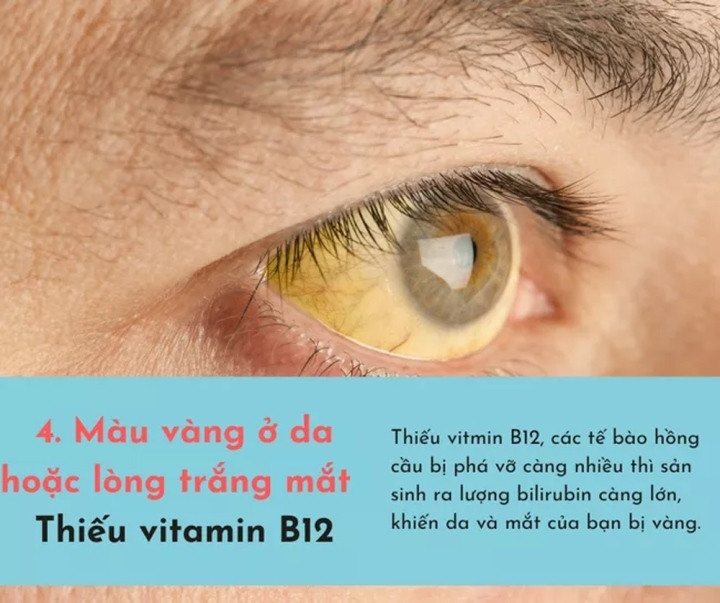 6 dấu hiệu báo động cơ thể thiếu nghiêm trọng vitamin - 4