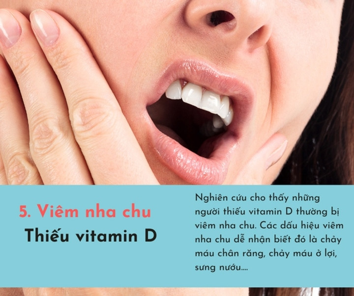 6 dấu hiệu báo động cơ thể thiếu nghiêm trọng vitamin - 5