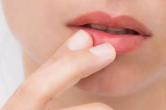 Cấp cứu đôi môi nứt nẻ mùa hanh khô