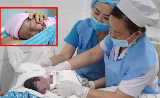 Tỉ lệ sinh mổ tăng cao vì sản phụ sợ đau, sợ xấu, sợ... không trúng giờ đẹp
