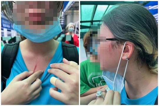 Học sinh trường quốc tế đánh nhau: UBND TP Hồ Chí Minh chỉ đạo khẩn