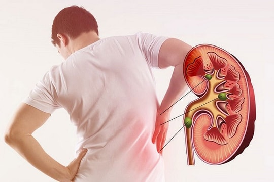 Những thói quen xấu dẫn đến suy thận
