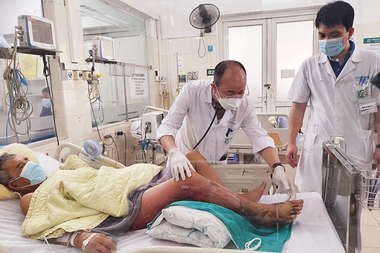 Hoại tử chân tím đen, suy gan thận do loại vi khuẩn có ở nước biển