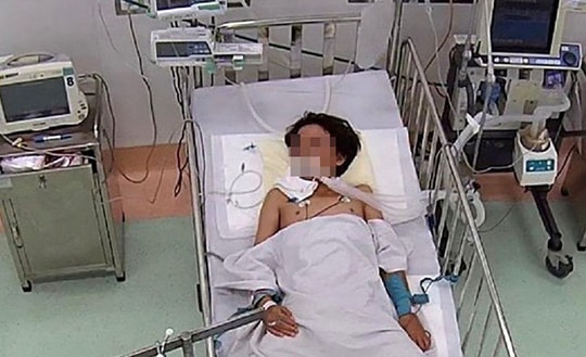 "Rắn cắn đến bệnh viện, chó cắn tiêm vắc xin"
