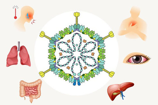 Adenovirus gây bệnh gì, cha mẹ cần làm gì khi trẻ mắc?