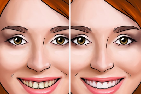 Những cách điều trị hiệu quả bệnh hôi miệng