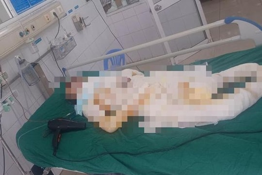 Vụ con gái đốt nhà mẹ ở Hưng Yên: Sau nhiều lần phẫu thuật, sức khỏe người mẹ vẫn rất yếu