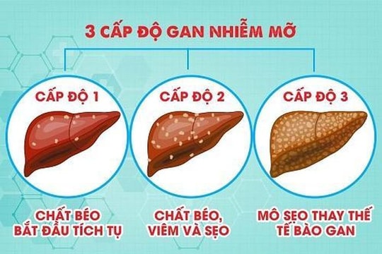 4 món ăn bài thuốc phòng trị gan nhiễm mỡ