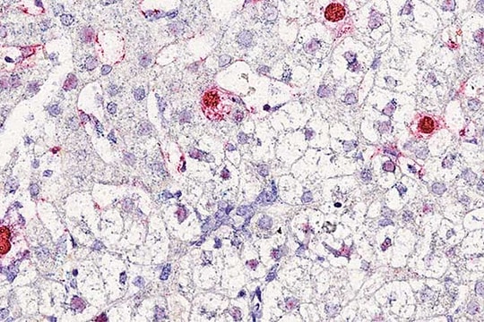 Phát hiện virus mới gây bệnh viêm gan ở người