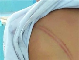 Khởi tố vụ án mẹ kế hành hạ con riêng của chồng