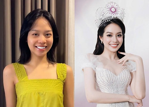 Vừa đăng quang, Hoa hậu Thanh Thuỷ thừa nhận phẫu thuật thẩm mỹ