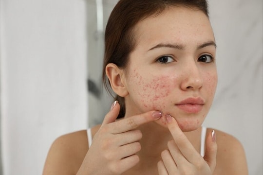 3 thành phần mỹ phẩm tránh dùng chung kẻo tiền mất, tật mang