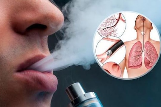 Thuốc lá điện tử "tấn công" trường học