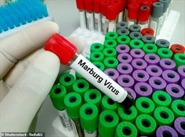 Tanzania tiếp tục ghi nhận trẻ em tử vong vì virus Marburg