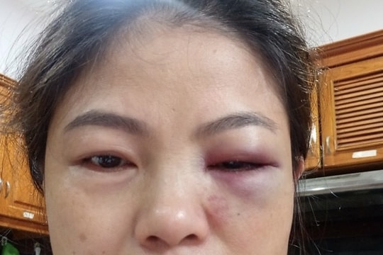  4 mẹ con ở Đồng Nai cầu cứu công an vì bị bạo hành
