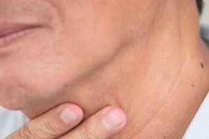 Phát hiện ung thư giai đoạn muộn sau 6 tháng điều trị nhầm
