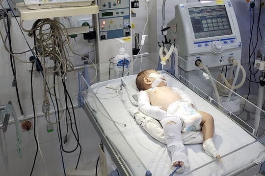Trẻ 3 tháng tuổi ở Lâm Đồng bị mẹ và cha dượng hành hạ đến gãy xương