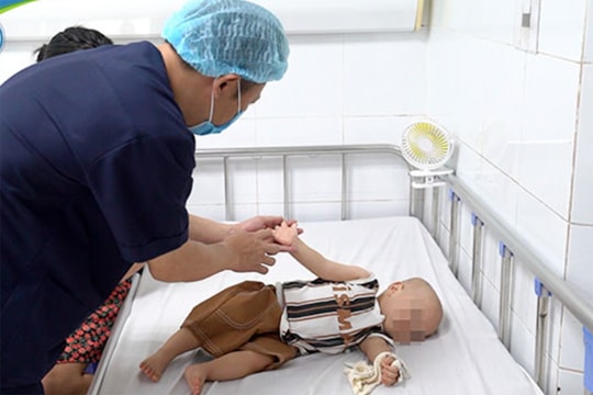 Hơn 1.200 trẻ nhập viện ở Hà Nội vì tay chân miệng, nhiều bé đã viêm não