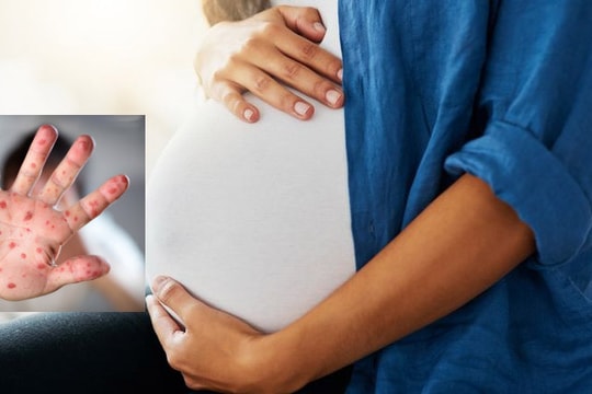 Thai phụ tiếp xúc với trẻ nhỏ mắc bệnh tay chân miệng có nguy hiểm không?